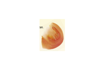 tomaten